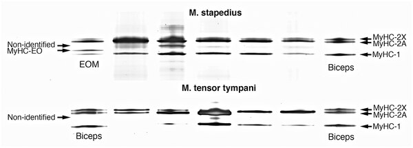 Western blot of human stapedius and tensor tympani middle ear muscle hymogenates blotted with DSHB antibody A4.951 (MyHC-1). PMID: 36914412, Fig. 5.